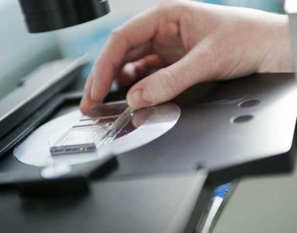 SAMe或成慢性結腸炎新希望？